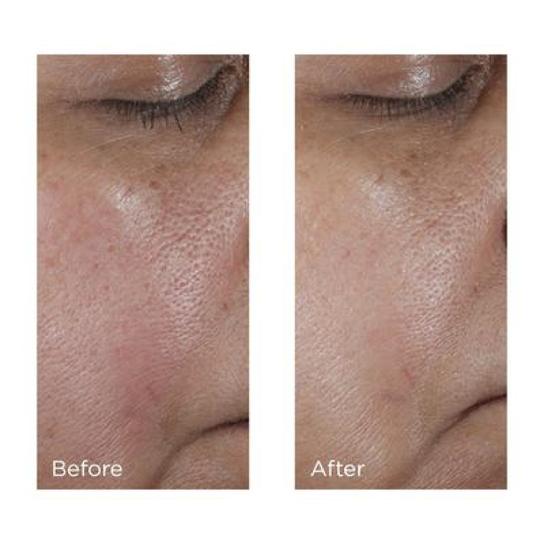 Perricone MD No:Rinse Intensive Pore Minimizing Toner 4 oz / 118 ml