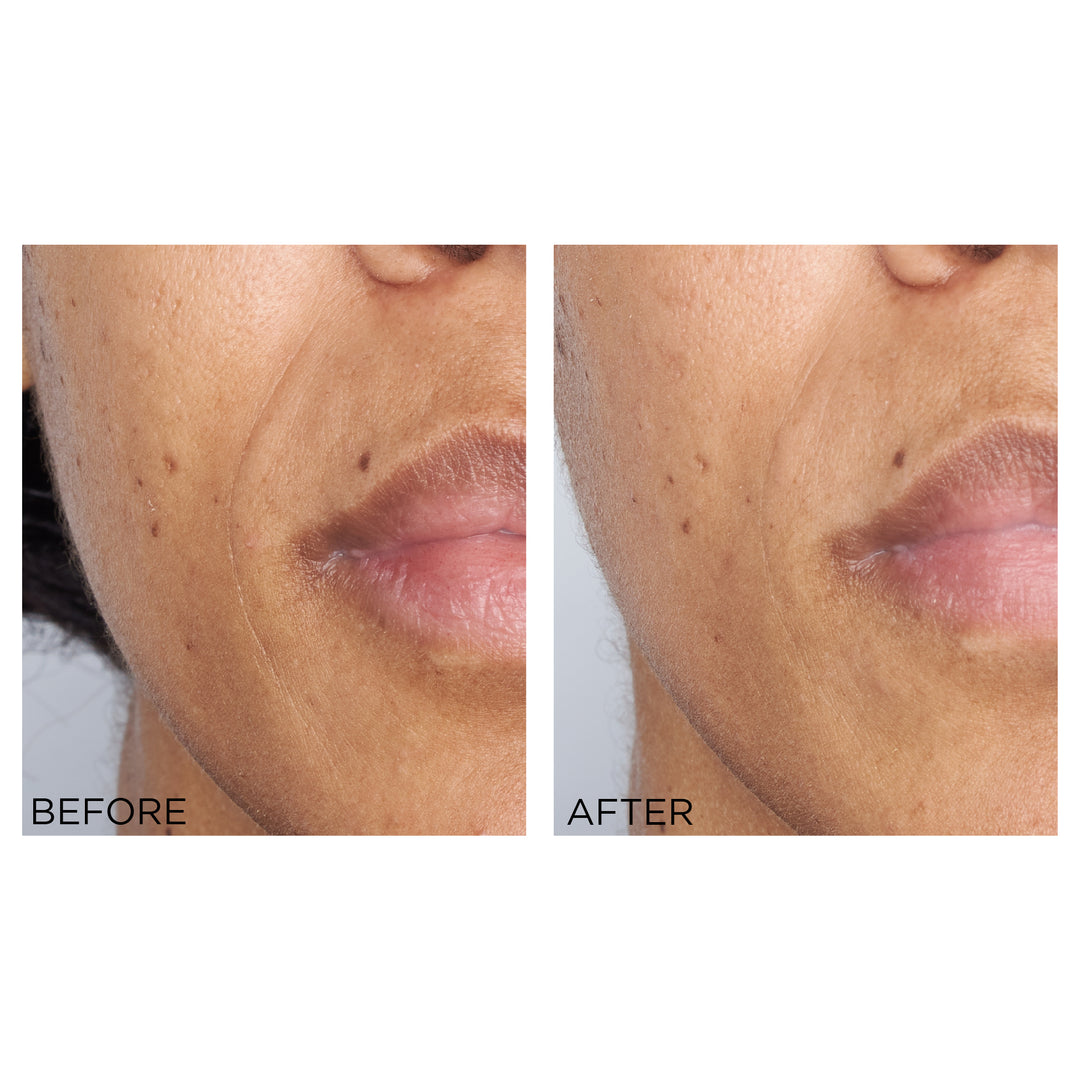 Perricone MD High Potency Retinol Recovery Overnight Moisturizer - Full Size