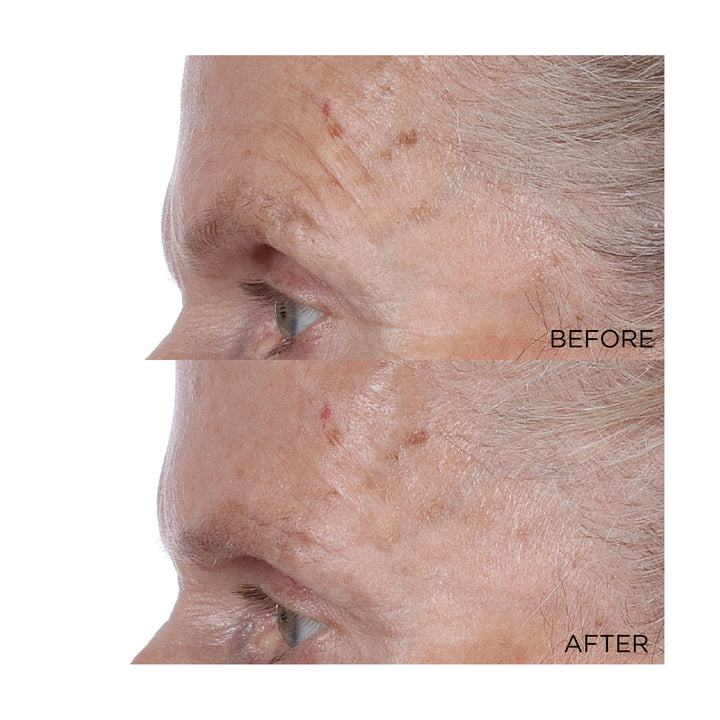 Perricone MD High Potency Face Finishing & Firming Toner - Full Sized