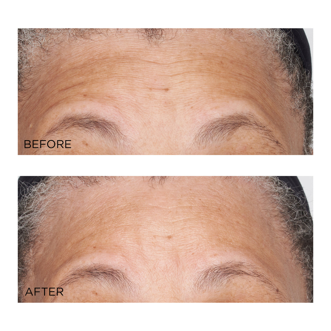 Perricone MD Hypoallergenic Clean Correction Barrier Repair Nourishing Moisturizer
