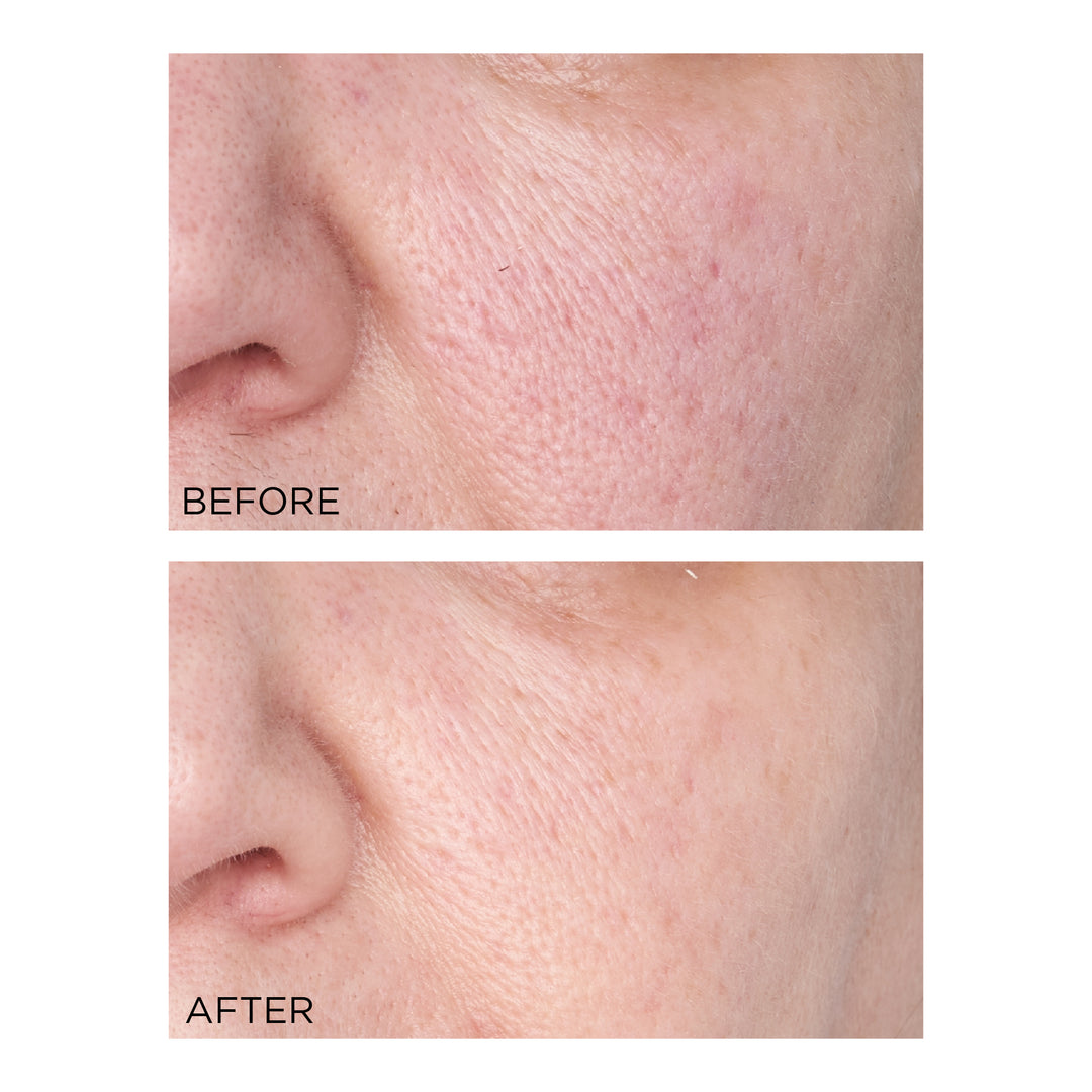 Perricone MD Hypoallergenic Clean Correction Smoothing Restorative Serum 2oz