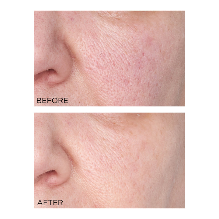 Perricone MD Hypoallergenic Clean Correction Smoothing Restorative Serum 2oz