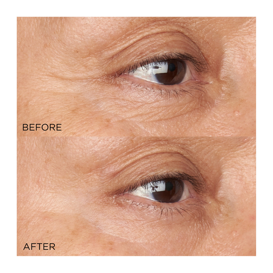 Perricone MD Hypoallergenic Clean Correction Firming & Brightening Eye Cream
