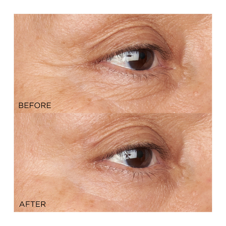 Perricone MD Hypoallergenic Clean Correction Firming & Brightening Eye Cream