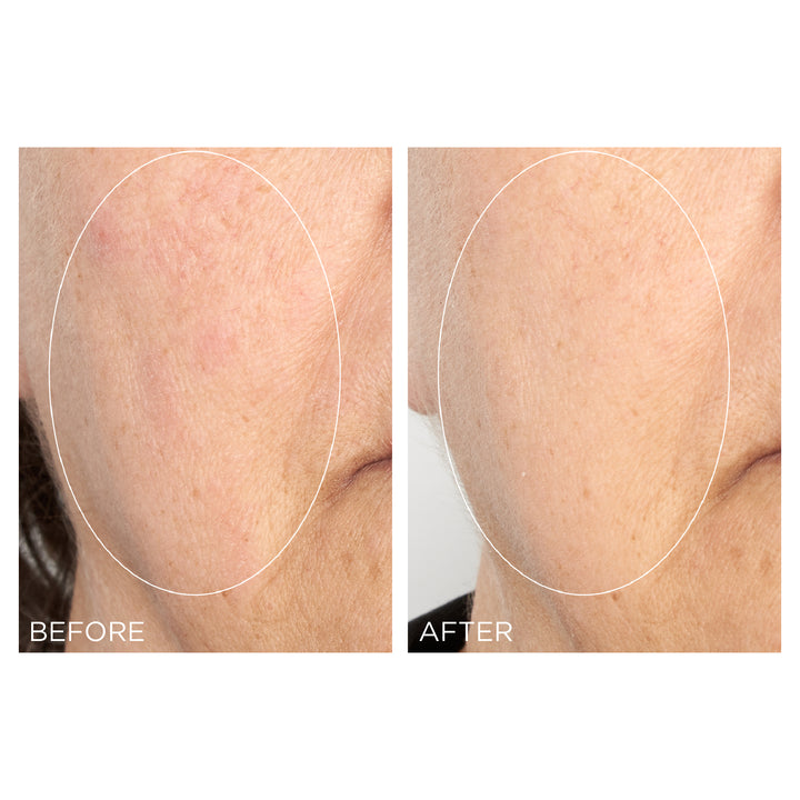 Perricone MD High Potency Intensive Smoothing Serum